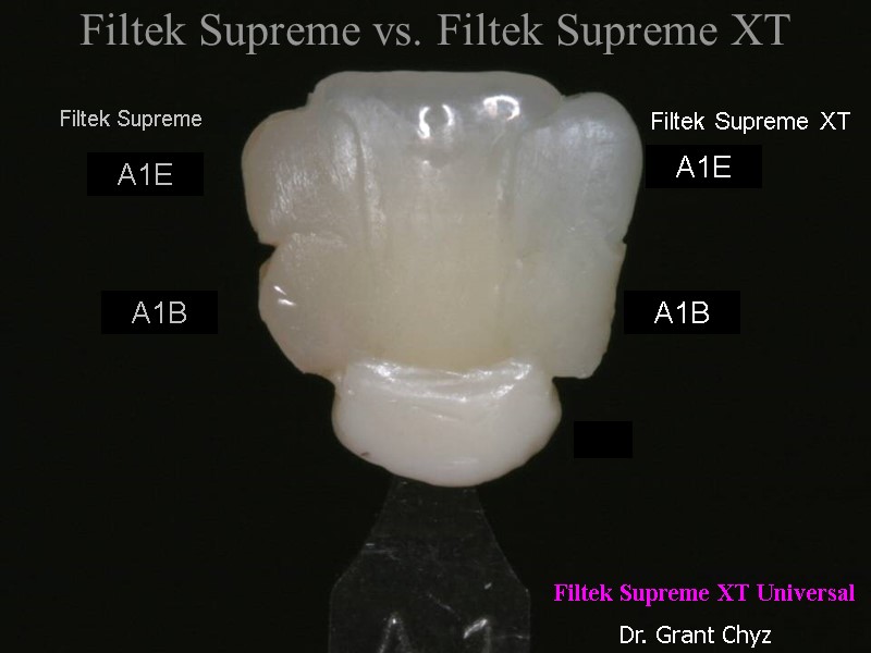 Filtek Supreme vs. Filtek Supreme XT Filtek Supreme Dr. Grant Chyz A1E A1B A1B Filtek Supreme vs. Filtek Supreme XT Filtek Supreme Dr. Grant Chyz A1E A1B A1B